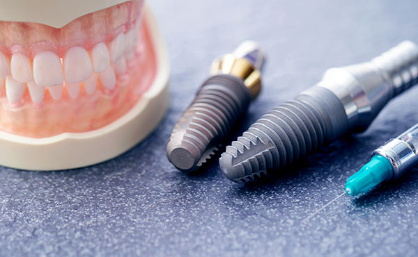 インプラントイメージ